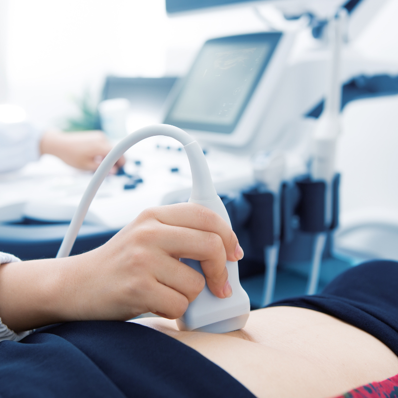 3D & 4D SONOGRAPHY